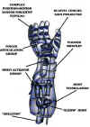 ultron-arm-specs.jpg (40154 bytes)